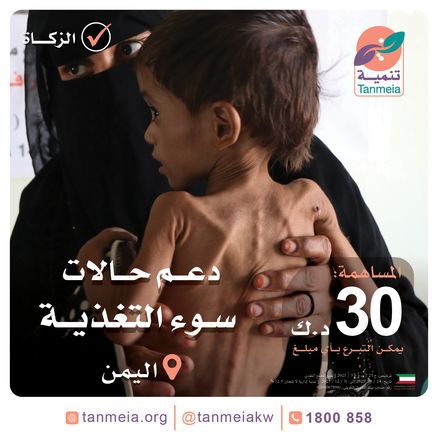 دعم حالات سوء التغذية | اليمن
