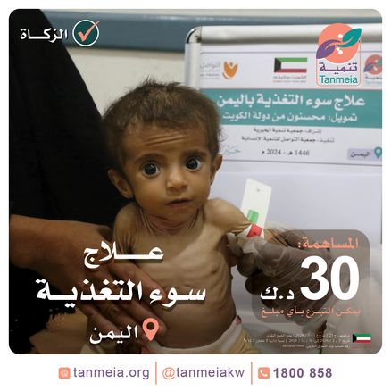 دعم حالات سوء التغذية | اليمن