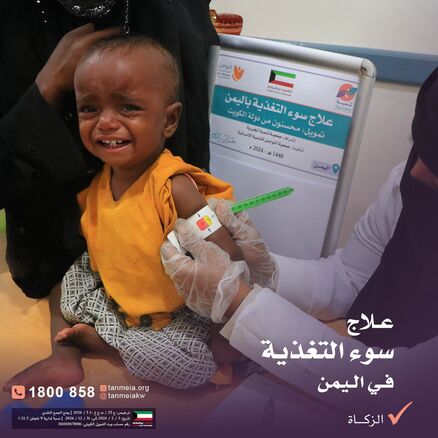 علاج سوء التغذية لأطفال اليمن